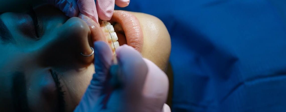 Leczenie korzenia zęba - resekcja
